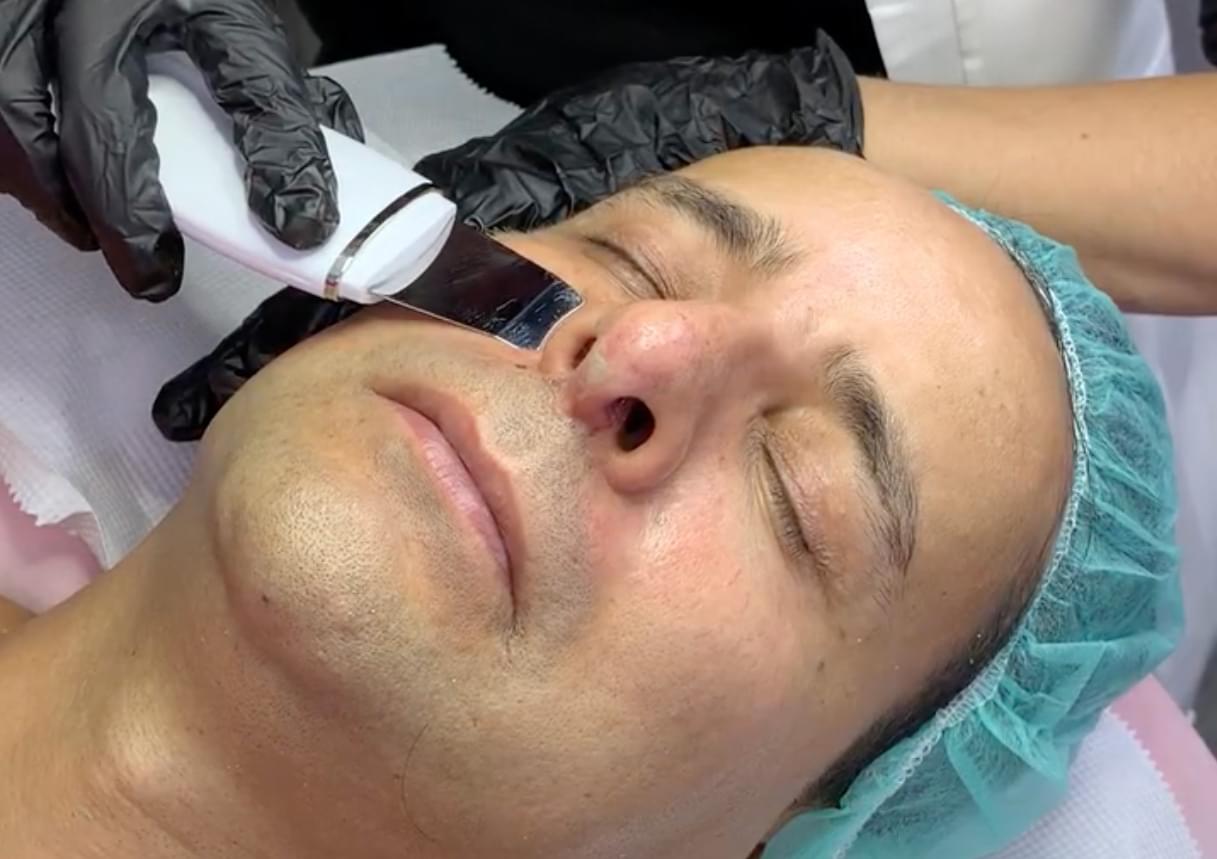 Limpieza Facial